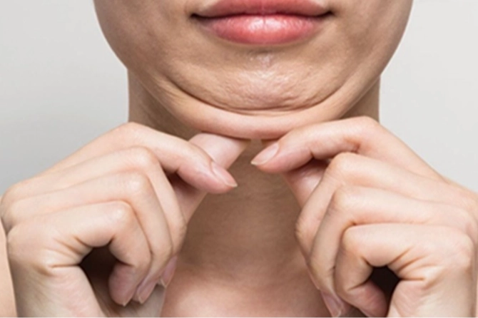 Keşanlı 3 dermatolog, Tiflis’teki Dermavizyon toplantısında buluştu